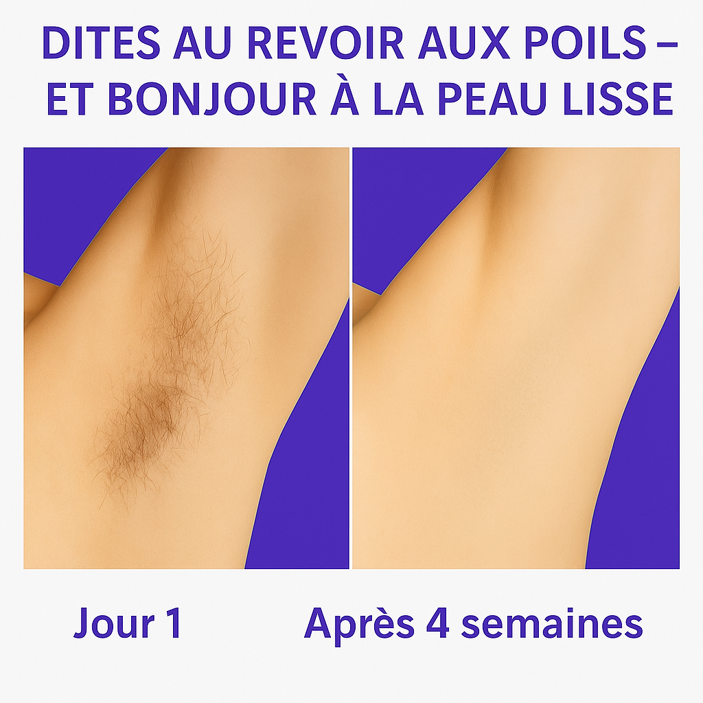 Nudéa - IPL. Épilateur à Lumière Pulsée